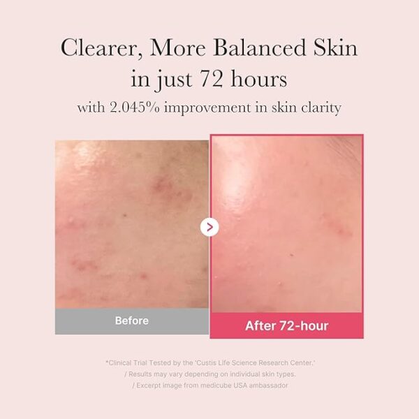 TXA+Niacinamide - Image 3