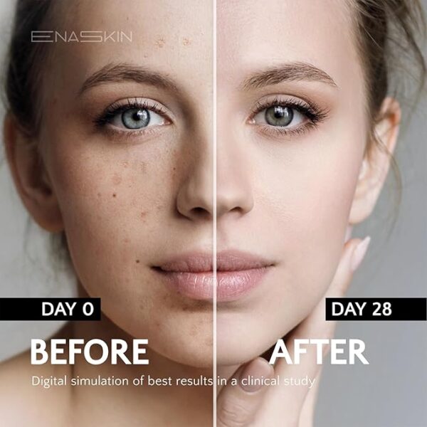 Dark Spot Remover - Image 2